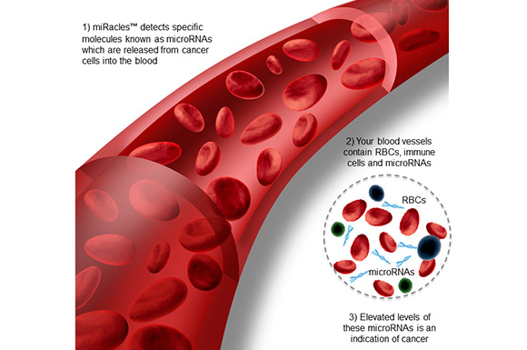 A new prognosis for oral cancer | University of Technology Sydney