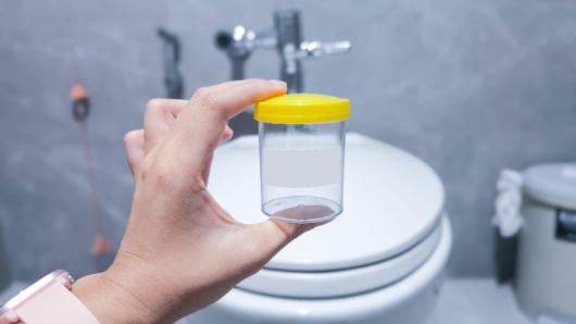 Urine test jar. Adobe Stock