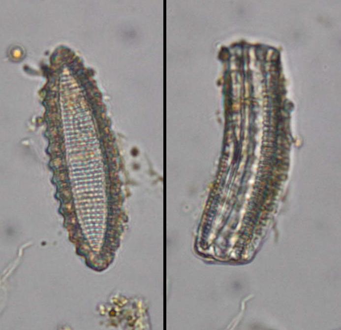 View down a microscope of a freshwater benthic diatom collected from Northern Queensland river