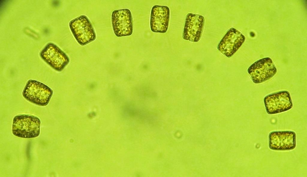 Thalassiosira chain, marine microbial community, Davis Station Antarctica