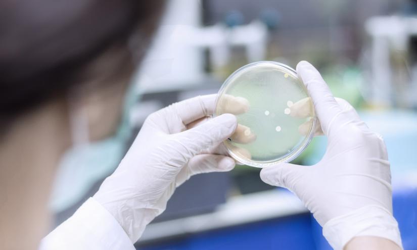 bacteria in a Petri dish