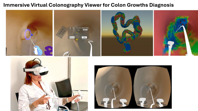 Images of VR and bowel
